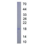 SDS-PAGE analysis of recombinant Mouse CA125 Protein.