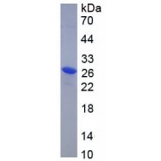 SDS-PAGE analysis of recombinant Rat CLCF1 Protein.