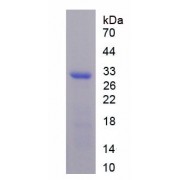 SDS-PAGE analysis of recombinant Rat CHRNa1 Protein.