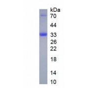 SDS-PAGE analysis of recombinant Human Collagen Type XII (COL12) protein.