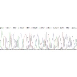 Rat Neutrophil Elastase / ELA2 (ELANE) Protein