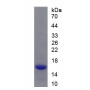 SDS-PAGE analysis of recombinant Human Glucagon Like Peptide 1 Receptor (GLP1R) Protein.