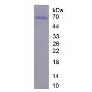 SDS-PAGE analysis of recombinant Mouse GRIN2A protein.