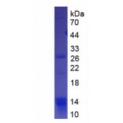 SDS-PAGE analysis of recombinant Human HVCN1 protein.