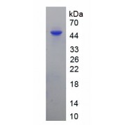 SDS-PAGE analysis of recombinant Mouse HPRT1 protein.
