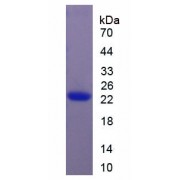 SDS-PAGE analysis of recombinant Rat IL11 Protein.