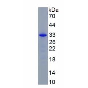 SDS-PAGE analysis of recombinant Large T Antigen (LT) Protein.