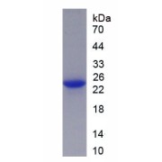 SDS-PAGE analysis of recombinant Rat Leukemia Inhibitory Factor (LIF) Protein.