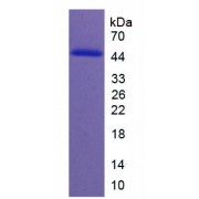 SDS-PAGE analysis of recombinant Human NEO1 Protein.
