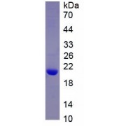 SDS-PAGE analysis of recombinant Human Perilipin 1 (PLIN1) Protein.