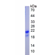 SDS-PAGE analysis of recombinant Human Potassium Intermediate Small Conductance Calcium Activated Channel Subfamily N, Member 2 (KCNN2) Protein.
