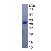 SDS-PAGE analysis of recombinant Human Transforming Protein RhoA (RHOA) Protein.