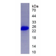 SDS-PAGE analysis of recombinant Human Semaphorin 3B (SEMA3B) Protein.