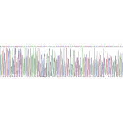 Human Tyrosinase (TYR) Protein