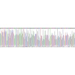 Human Tyrosinase (TYR) Protein