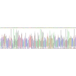 Human Carcinoembryonic Antigen-Related Cell Adhesion Molecule 5 (CEACAM5) Protein (Active)