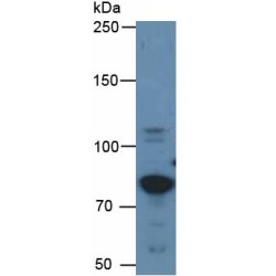 Human Carcinoembryonic Antigen-Related Cell Adhesion Molecule 5 (CEACAM5) Protein (Active)