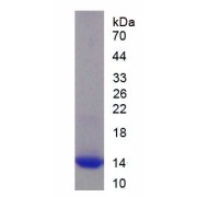 SDS-PAGE analysis of recombinant Human Fibroblast Growth Factor 23 (FGF23) Protein.