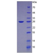 SDS-PAGE analysis of recombinant Mouse Somatotropin (GH1) Protein (Active).
