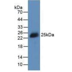 Human Interferon Beta (IFNb) Protein (Active)