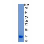 SDS-PAGE analysis of recombinant active Interleukin-8 (IL8) protein.