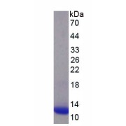 SDS-PAGE analysis of recombinant Human Parathyroid Hormone Protein.