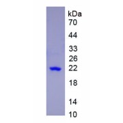 SDS-PAGE analysis of recombinant Human Retinol Binding Protein 4, Plasma (RBP4) Protein.