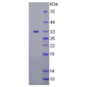 SDS-PAGE analysis of recombinant Human TAT Protein.