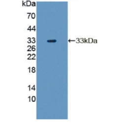 Human Tyrosine Aminotransferase (TAT) Protein (Active)