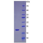 SDS-PAGE analysis of recombinant Human UGCG Protein.