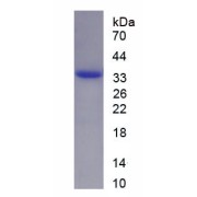 SDS-PAGE analysis of recombinant Human FNDC5 Protein.