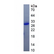 SDS-PAGE analysis of recombinant SARS-CoV-2 Spike Protein.