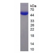SDS-PAGE analysis of recombinant SARS-CoV-2 Nucleoprotein.