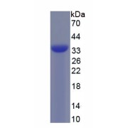 SDS-PAGE analysis of recombinant Human Neurexin 3 (NRXN3) Protein.