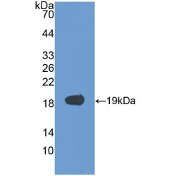 Human Vascular Endothelial Growth Factor 165 (VEGF165) Protein