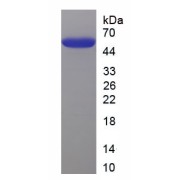 SDS-PAGE analysis of recombinant Human Keratin, type I cytoskeletal 17 (KRT17) Protein.