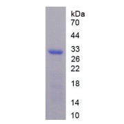 abx655935