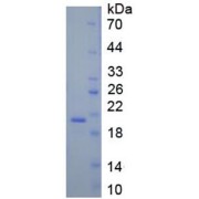 SDS-PAGE analysis of recombinant Mouse MYDGF Protein.