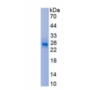 SDS-PAGE analysis of recombinant Human Interferon Beta (IFNB1) Protein.