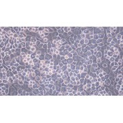 Morphology of Mouse Articular Chondrocytes (200X).