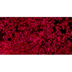 Mouse Articular Chondrocytes (AC)