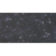 Morphology of Mouse Intervertebral Disc Annulus Cells (100X).