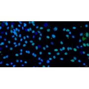 Immunofluorescence identification of Collagen Type II (COL2A1) (400X).