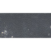 Morphology of Rat Thymic Fibroblasts (Optical microscope, 100X).