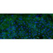 Immunofluorescence identification of ZO-1 (200X).