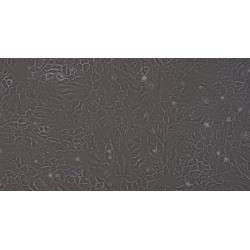 Rat Osteoblasts (OB)