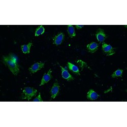 Rat Osteoblasts (OB)