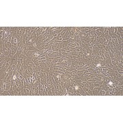 Morphology of P2 OB (Optical microscope, 100X).
