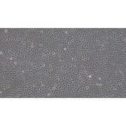 Morphology of Rat Hepatic Sinusoidal Endothelial Cells (100X).