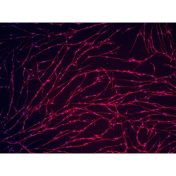 Rat Trigeminal Ganglion Neuron Cells (TGN)